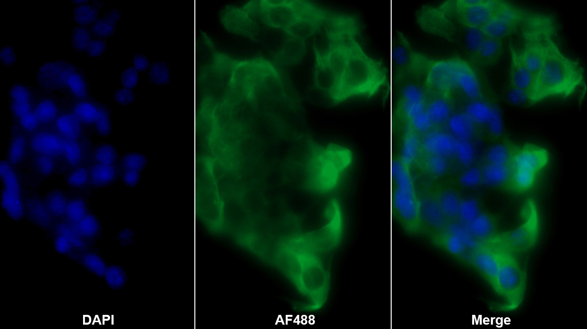 Polyclonal Antibody to Fatty Acid Synthase (FASN)