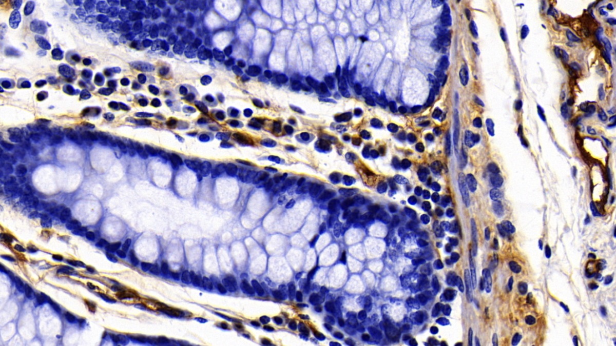 Polyclonal Antibody to Fibrinogen Gamma (FGg)