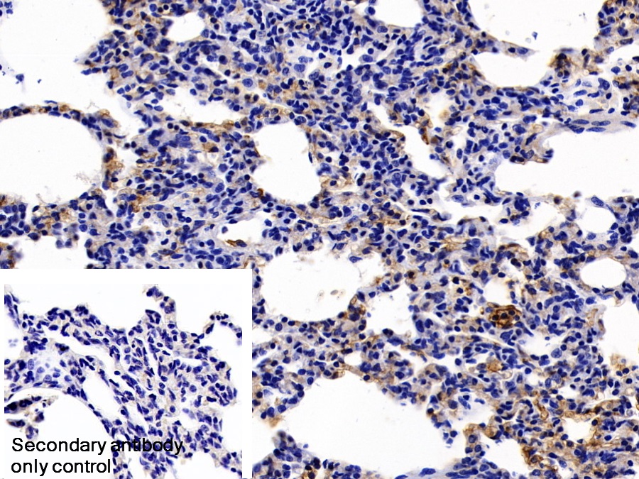 Polyclonal Antibody to Fibrinogen Gamma (FGg)