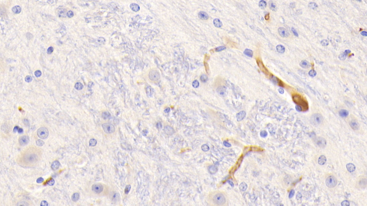 Polyclonal Antibody to Fibrinogen Gamma (FGg)