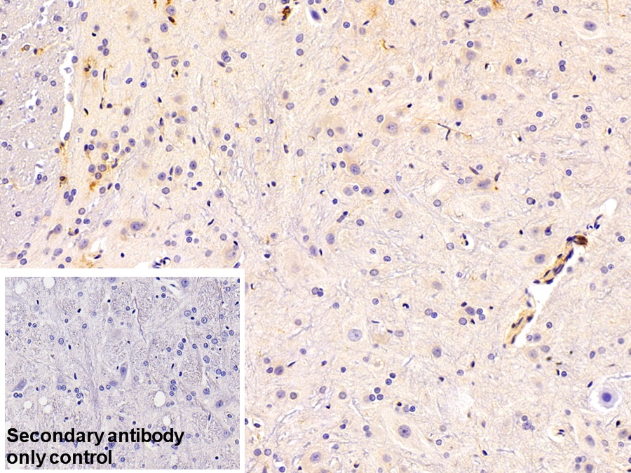 Polyclonal Antibody to Fibrinogen Gamma (FGg)