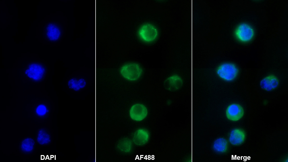Polyclonal Antibody to Fucose-1-Phosphate Guanylyltransferase (FPGT)