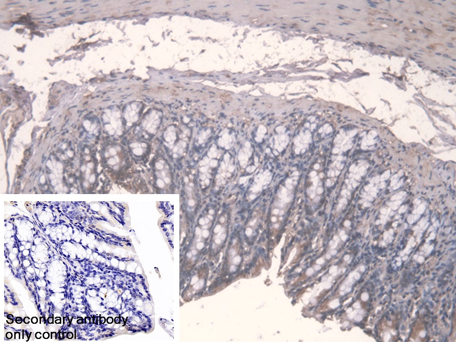 Polyclonal Antibody to Fucose-1-Phosphate Guanylyltransferase (FPGT)