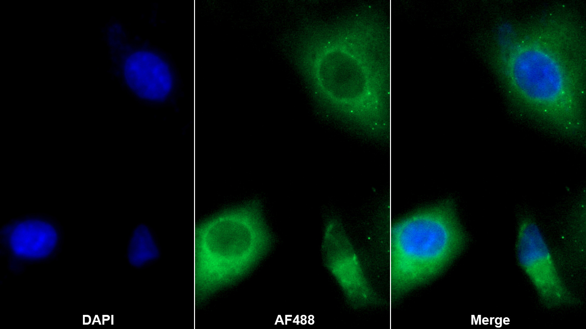 Polyclonal Antibody to Ferrochelatase (FECH)