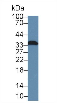 Polyclonal Antibody to Fibrillarin (FBL)