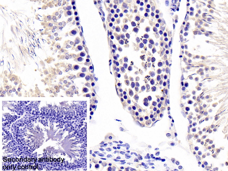 Polyclonal Antibody to Fibrillarin (FBL)