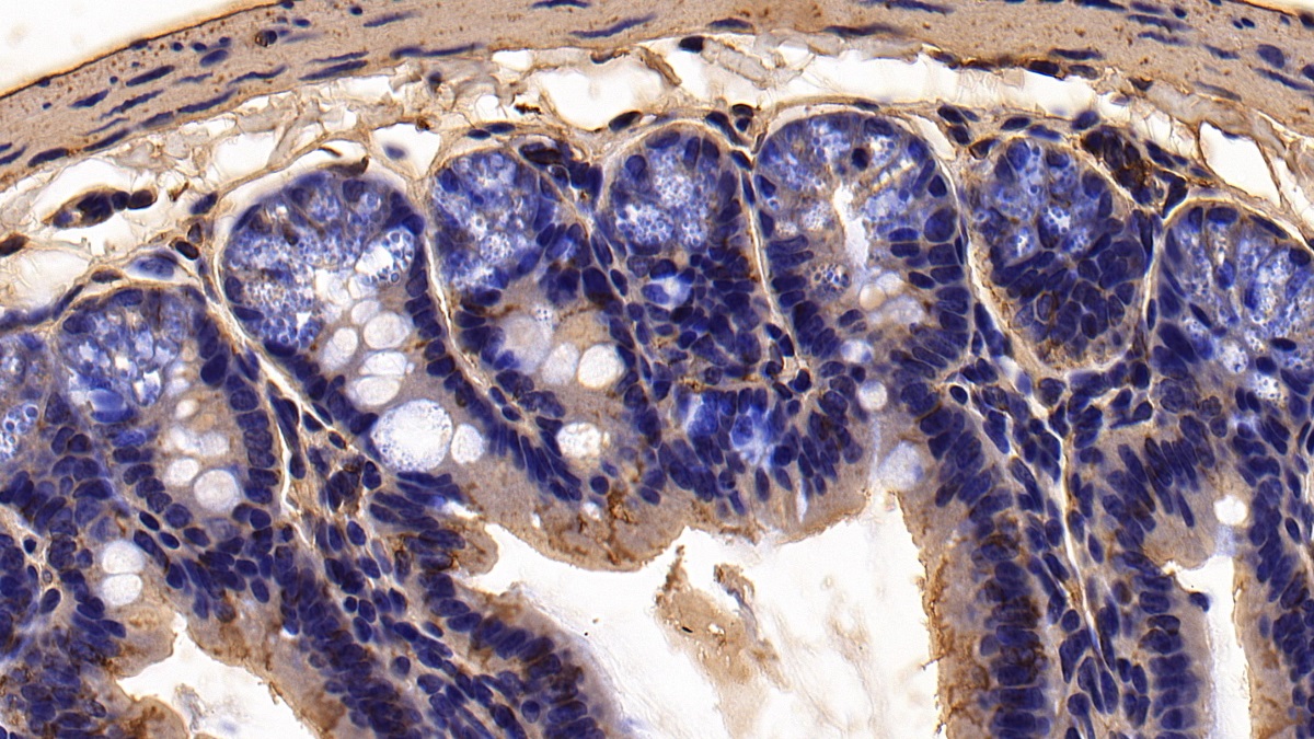 Polyclonal Antibody to Furin (FUR)