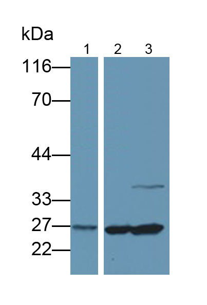 Polyclonal Antibody to Guanidinoacetate-N-Methyltransferase (GAMT)