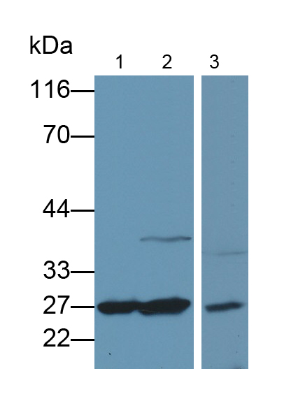 Polyclonal Antibody to Guanidinoacetate-N-Methyltransferase (GAMT)