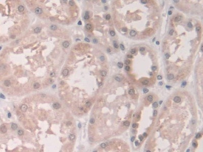 Polyclonal Antibody to Grancalcin (GCA)