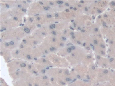 Polyclonal Antibody to G-Elongation Factor, Mitochondrial 1 (GFM1)
