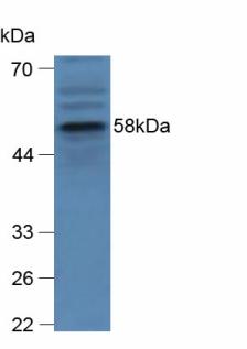 Polyclonal Antibody to Glucocerebrosidase (GBA)