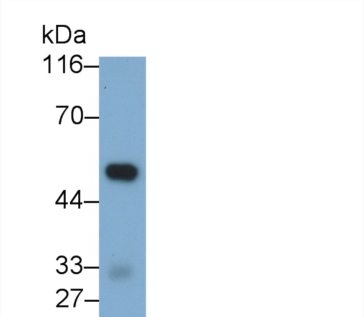 Polyclonal Antibody to Glucocerebrosidase (GBA)