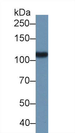 Polyclonal Antibody to Prostate-specific Membrane Antigen (PMSA)