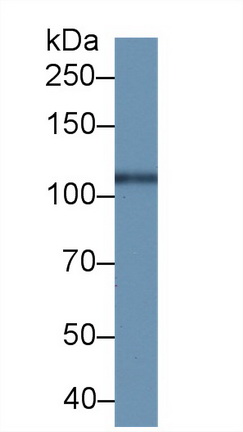 Polyclonal Antibody to Prostate-specific Membrane Antigen (PMSA)