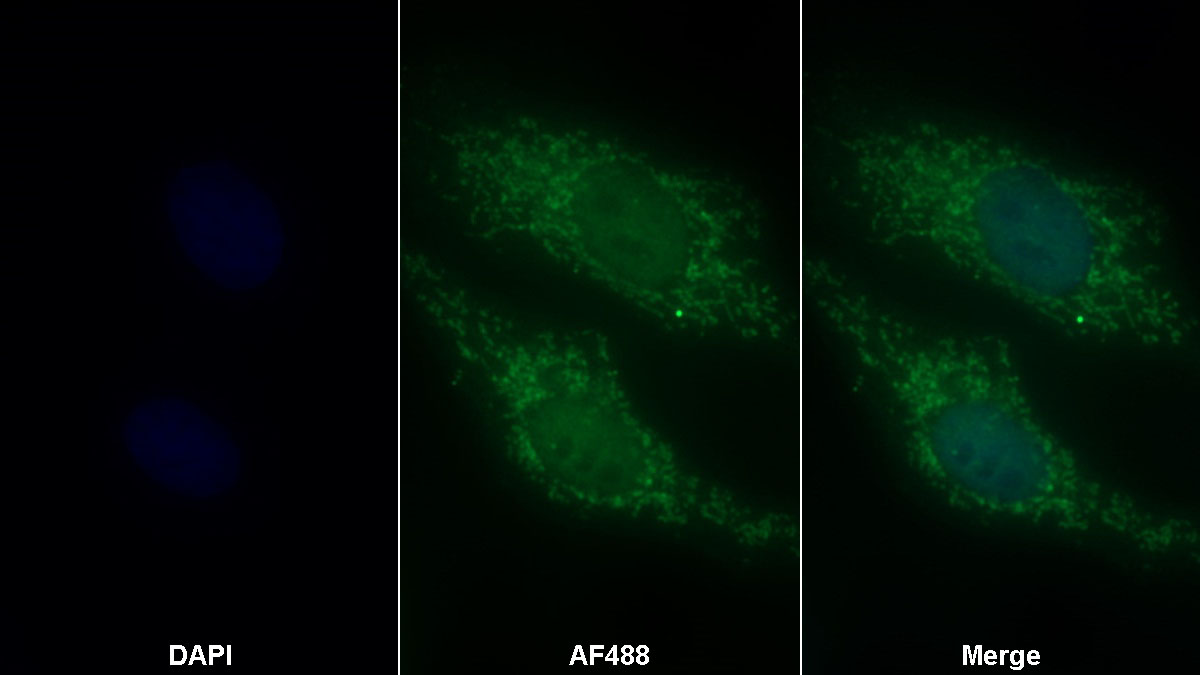 Polyclonal Antibody to Granulin (GRN)