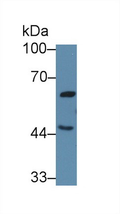 Polyclonal Antibody to Growth Hormone Releasing Hormone Receptor (GHRHR)