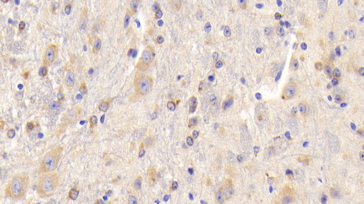 Polyclonal Antibody to Heart And Neural Crest Derivatives Expressed Protein 1 (HAND1)