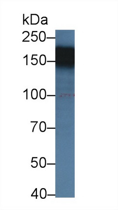 Polyclonal Antibody to High Density Lipoprotein Binding Protein (HDLBP)