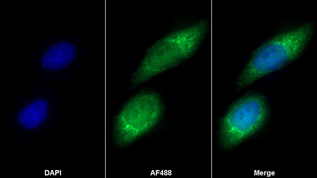 Polyclonal Antibody to High Density Lipoprotein Binding Protein (HDLBP)