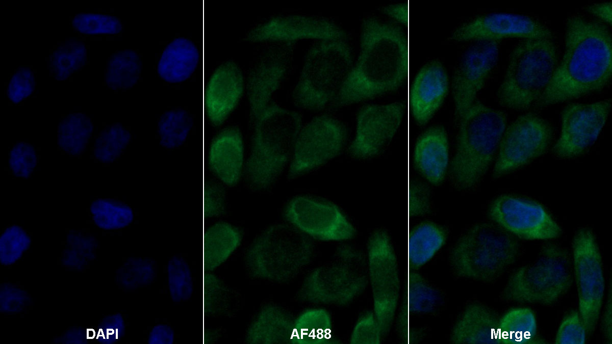 Polyclonal Antibody to High Density Lipoprotein Binding Protein (HDLBP)