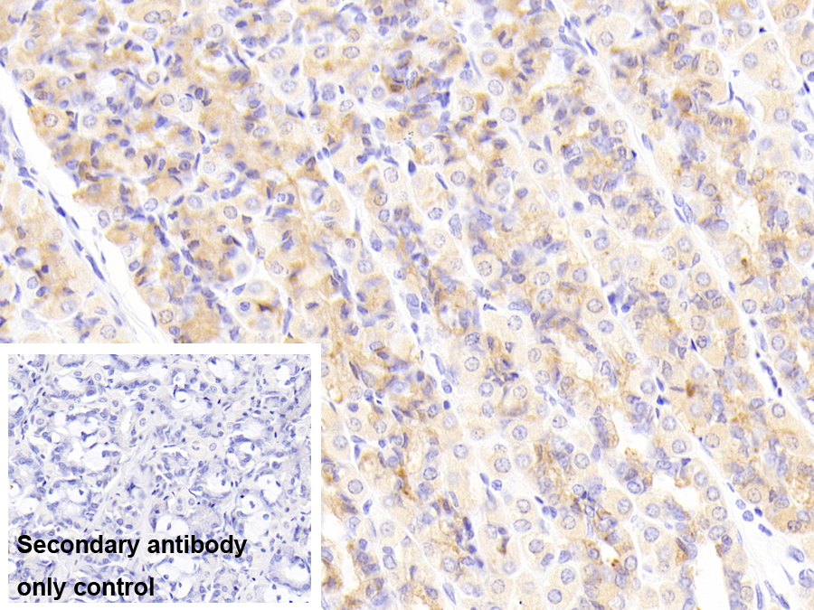 Polyclonal Antibody to High Density Lipoprotein Binding Protein (HDLBP)