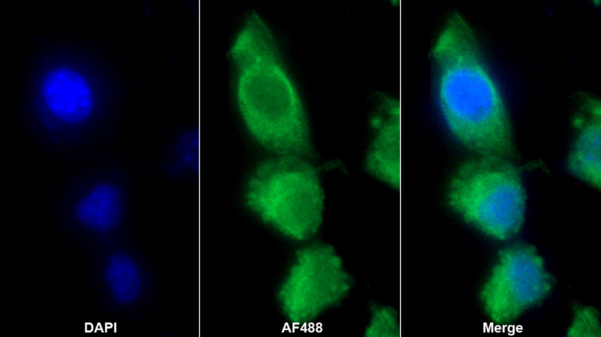 Polyclonal Antibody to Histidine Rich Glycoprotein (HRG)