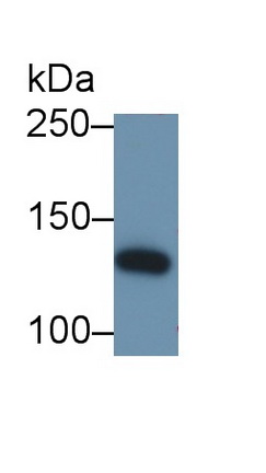 Polyclonal Antibody to Insulin Receptor Substrate 1 (IRS1)