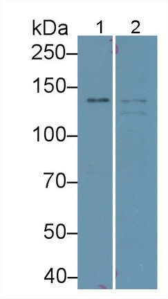 Polyclonal Antibody to Insulin Receptor Substrate 1 (IRS1)