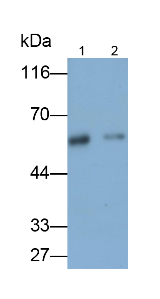 Polyclonal Antibody to Katanin P60 Subunit A 1 (KATNA1)