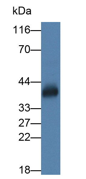Polyclonal Antibody to Legumain (LGMN)
