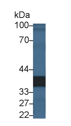 Polyclonal Antibody to Legumain (LGMN)