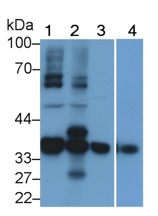 Polyclonal Antibody to Pim-1 Oncogene (PIM1)