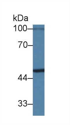 Polyclonal Antibody to Pim-1 Oncogene (PIM1)