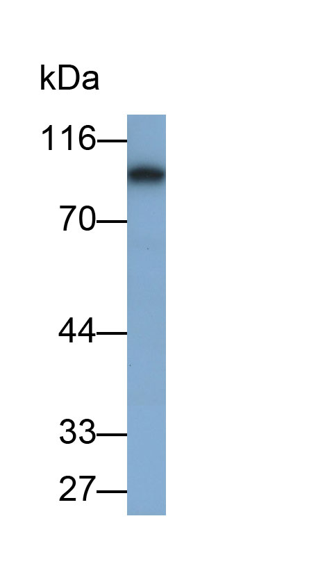 Polyclonal Antibody to Villin (VIL)