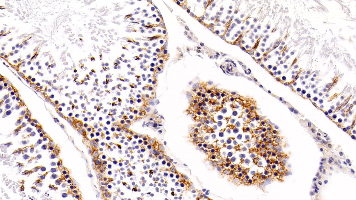 Polyclonal Antibody to Virus Induced Signaling Adapter (VISA)