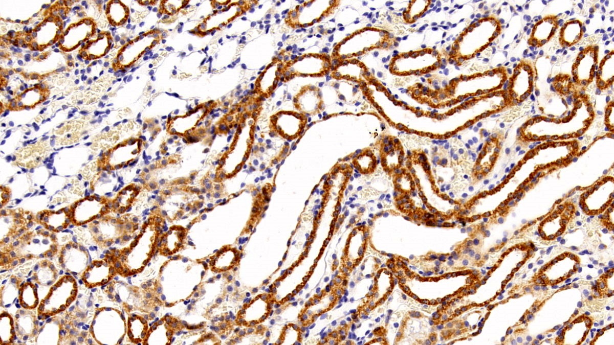 Polyclonal Antibody to Virus Induced Signaling Adapter (VISA)