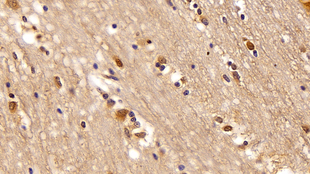 Polyclonal Antibody to Valosin Containing Protein (VCP)