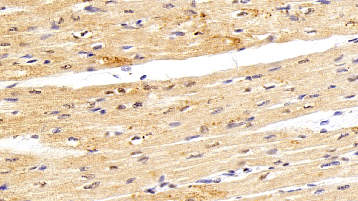 Polyclonal Antibody to Valosin Containing Protein (VCP)