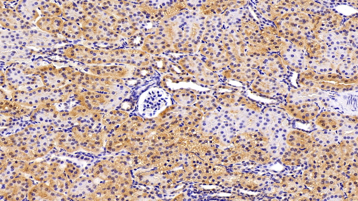 Polyclonal Antibody to Valosin Containing Protein (VCP)