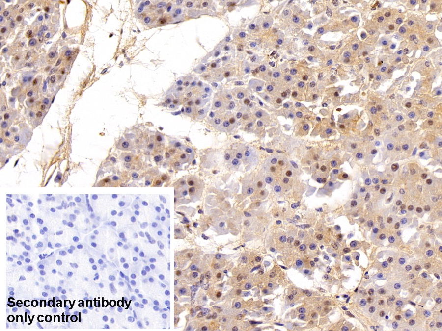 Polyclonal Antibody to Valosin Containing Protein (VCP)