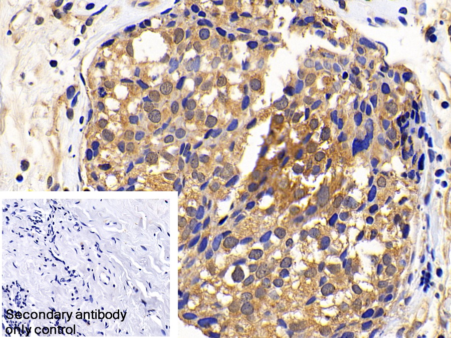 Polyclonal Antibody to X-linked Inhibitor Of Apoptosis Protein (XIAP)