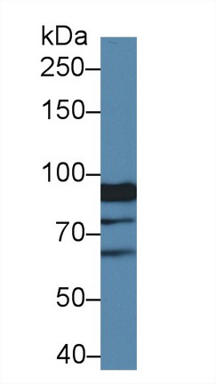 Polyclonal Antibody to Xylosyltransferase II (XYLT2)