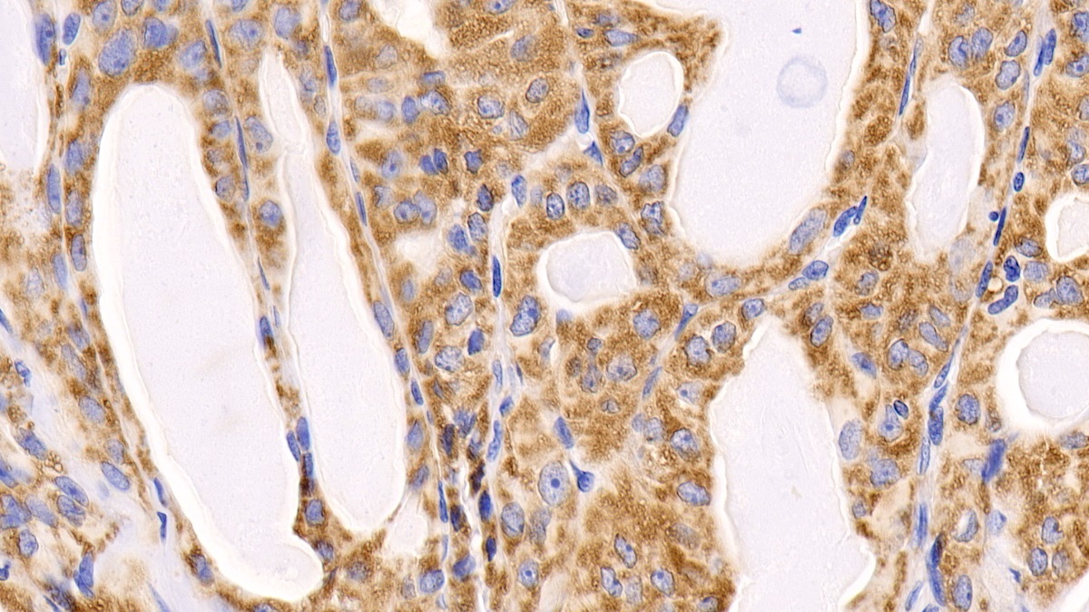 Polyclonal Antibody to Induced Myeloid Leukemia Cell Differentiation Protein Mcl-1 (MCL1)