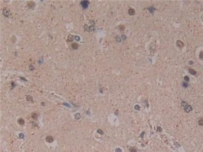 Polyclonal Antibody to Microfibrillar Associated Protein 2 (MFAP2)