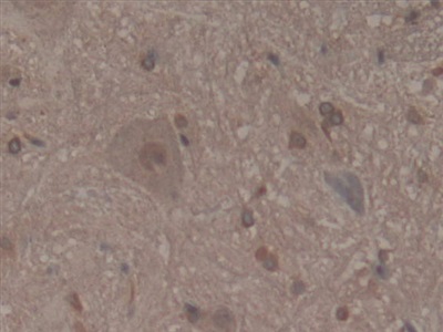 Polyclonal Antibody to Microfibrillar Associated Protein 2 (MFAP2)