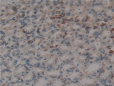 Polyclonal Antibody to Microfibrillar Associated Protein 2 (MFAP2)