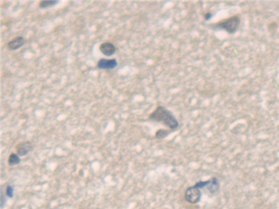 Polyclonal Antibody to N-Ethylmaleimide Sensitive Factor (NSF)