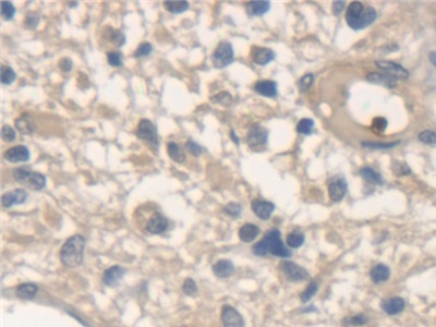 Polyclonal Antibody to N-Ethylmaleimide Sensitive Factor (NSF)