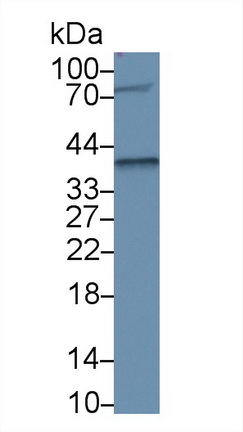 Polyclonal Antibody to Nucleophosmin 1 (NPM1)